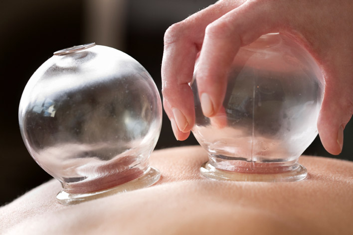 KS Remedial Massage Services - Chinese Cupping Therapy ...
